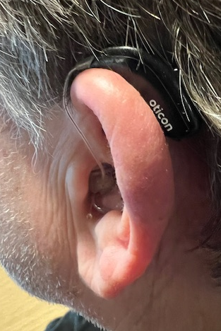Øre med høreapparat